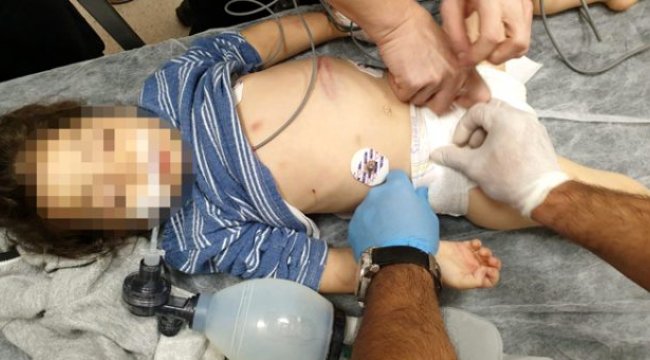 Vahşetin bu kadarı... Komaya giren çocuğu üvey annesinin dövdü