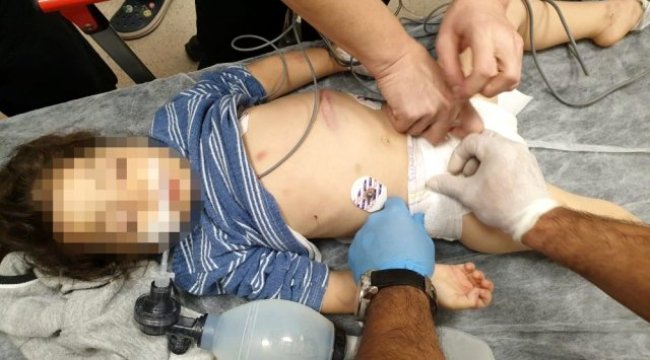 Üvey annenin komaya soktuğu küçük kıza devlet sahip çıktı