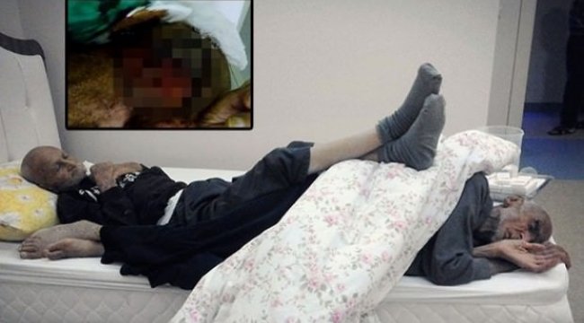 Dehşet görüntüler: Kafasında kurtçuklar...
