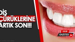 Diş Çürüklerine Artık Son!!!