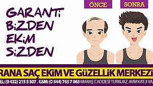 RANA SAÇ EKİM MERKEZİ - 05447657065 - Van saç ekim ve Van güzellik merkezinde dev indirimler