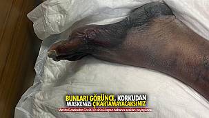 Van'da bunları görünce, korkudan maskenizi çıkaramayacaksınız -Evlattan Babaya koronavirüs...