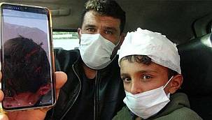 Van'da Bir Çocuğa Akıl Almaz İşkence Uygulandı