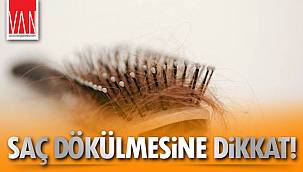 Saç Dökülmesine Dikkat! Bazı Hastalıkların Habercisi Olabilir