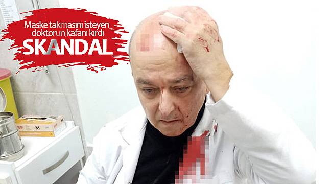 Maske takmasını isteyen doktorun kafanı kırdı - Skandal