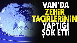 Van'da Zehir Tacirlerinin Yaptığı Şok Etti- Zehri Midelerinde Sakladılar