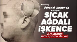 Özel öğrenci yurdunda vahşet! İddiaya göre; İşkenceciler arasında milli sporcu da var