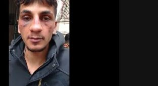 İki kardeş ara sokakta darp edildi