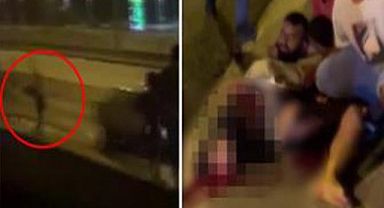 YARIŞI İZLERKEN BACAĞINDAN OLDU