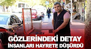 Gözlerindeki detay görenleri hayrete düşürdü!