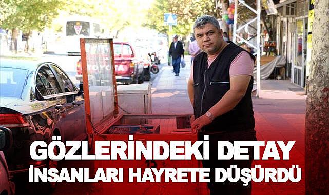 Gözlerindeki detay görenleri hayrete düşürdü!