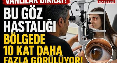 Van'da Uzmanlar bu göz hastalığına dikkat çekti