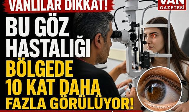 Van'da Uzmanlar bu göz hastalığına dikkat çekti