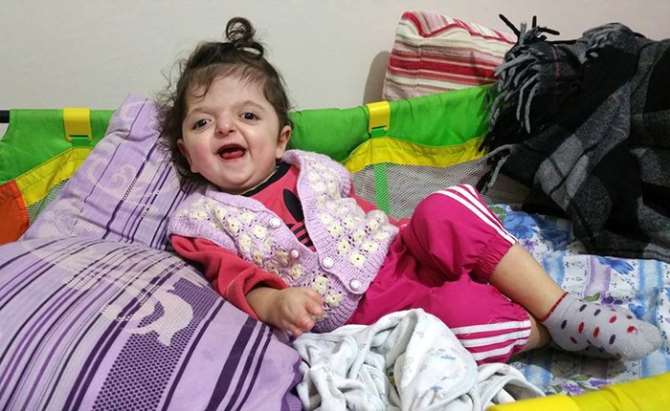 Minik Mira 3 Kişiye Umut Oldu