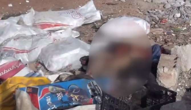 Vahşet: Bacağına ’namus İçin’ Yazdılar